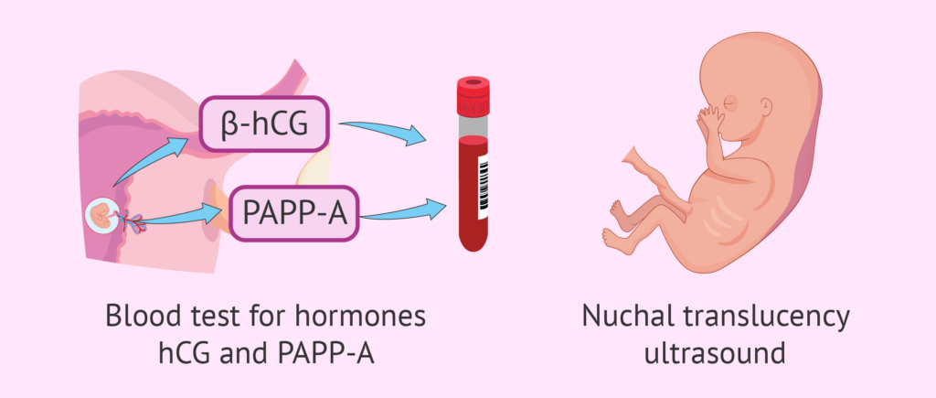 triple screening test